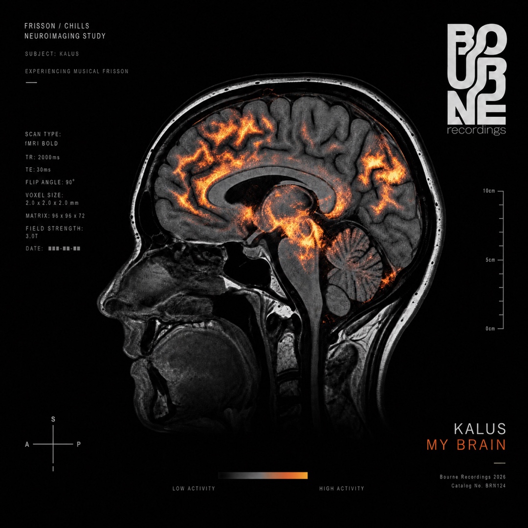 My Brain artwork